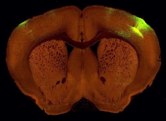 Sección del cerebro de un ratón.