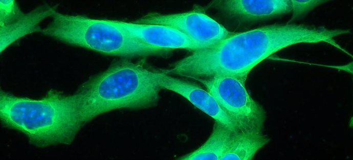 La línea celular del melanoma humano crece en el cultivo de tejidos