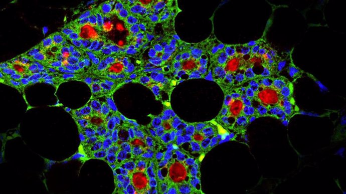 Sección de una glándula mamaria generada por células madre epiteliales dentales (verde: células epiteliales dentales, azul: núcleo de células, rojo: caseína de proteína específica de la leche).