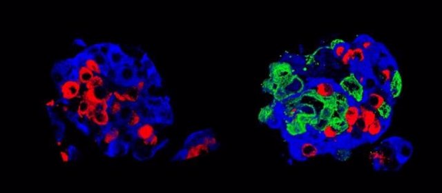 Un islote de Langerhans estándar, y derecha: un "super islote". Las células de insulina (células beta) están en azul y las células de glucagón (células alfa) en rojo; el superislote tiene, además, células epiteliales amnióticas, en verde.