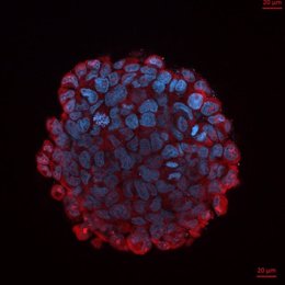 Un inhibidor de microARN identificado por investigadores del Centro de Investigación de Genoma Humano y Células Madre, apoyado por FAPESP, redujo el tamaño de los tumores agresivos y mejoró la supervivencia en ratones.