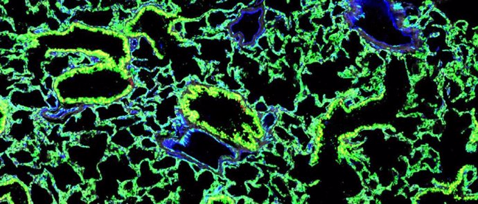 Imagen microscópica de uno de los pulmones en ratones. Las células madre trasplantadas brillan por la presencia de proteína verde fluorescente.