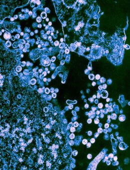Las partículas de la cepa Josiah del virus Lassa (redondo) se muestran en gemación de las células.