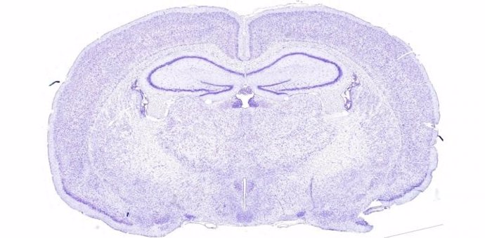 Sección transversal del cerebro de rata. Para asegurarse de que el núcleo supraquiasmático se había desactivado correctamente, los investigadores examinaron posteriormente varias histologías como ésta.