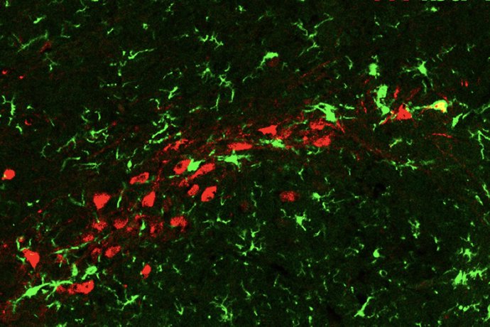 Las neuronas de dopamina senescentes (rojas) desencadenan una inflamación local y son atacadas por las células inmunitarias del cerebro, la microglia (verde).