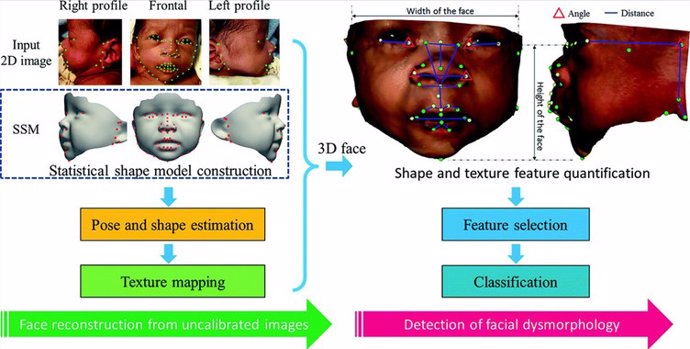 Imagen del método propuesto para la reconstrucción de la cara en 3D e identificación de la dismorfología facial asociada con síndromes genéticos. /