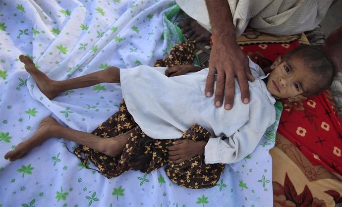 Niño afectado de tifoidea en Pakistán