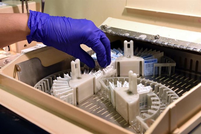 Muestras patológicas.