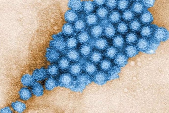 Los microbios intestinales pueden reducir o aumentar la gravedad de la infección por norovirus en función del lugar a lo largo del intestino donde se asiente el virus.  Se muestran partículas de norovirus.
