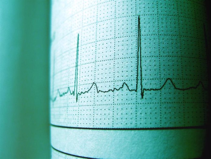 Imagen de un electrocardiograma