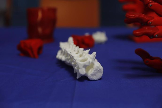 Impressions 3D de diversos ossos del cos hum a l'Hospital Són Espases de Palma.