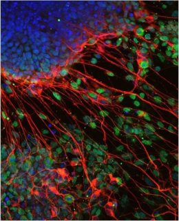 Neuronas derivadas de células madre en ausencia de factores T-Box.