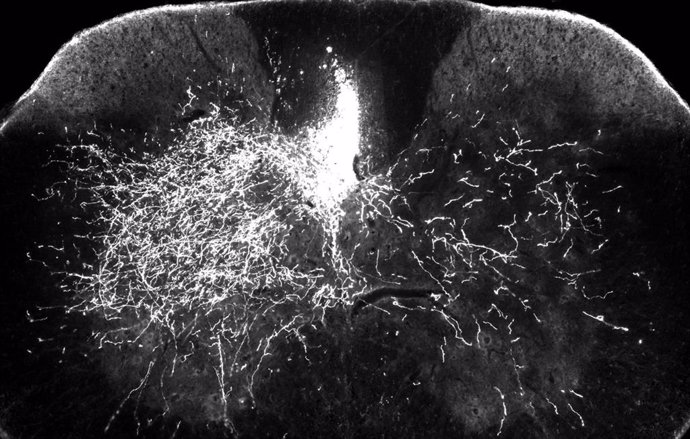 Rayas brillantes a la derecha muestran que en ratones tratados con gabapentina, los axones motores descendentes son capaces de brotar para enviar impulsos nerviosos a la parte denervada de la médula espinal, paso clave para reconstruir el sistema nervio