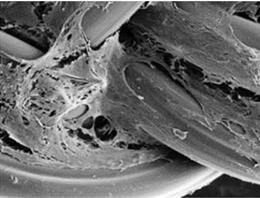 Crecimiento de células madre (células mesenquimales) sobre el trenzado de hijuelas de gusano.