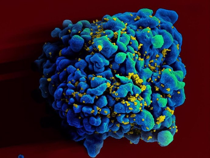 Escaneo electromicrográfico de una célula T infectada con VIH. 