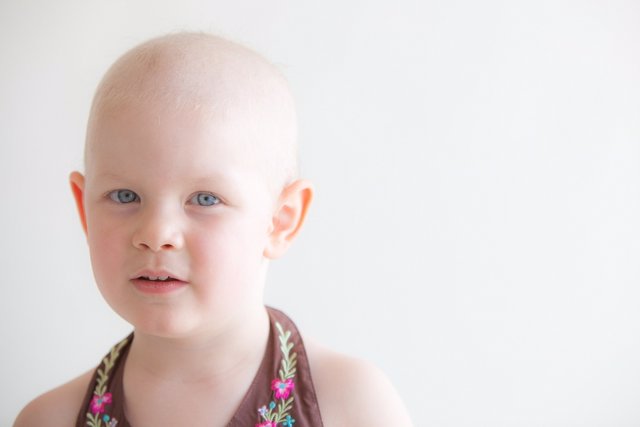 Imagen de recurso de una niña con cáncer, cáncer infantil