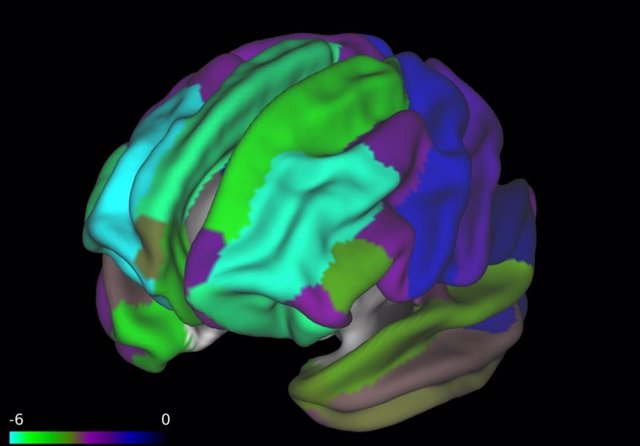 El color cian es la corteza prefrontal. Mientras que toda la corteza mostró adelgazamiento entre los niños obesos en el estudio, el adelgazamiento fue mayor en el área prefrontal, como lo muestra la escala de colores.