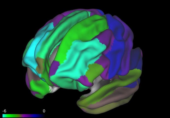 Los niños obesos tienen una corteza cerebral más fina, lo que puede afectar a su