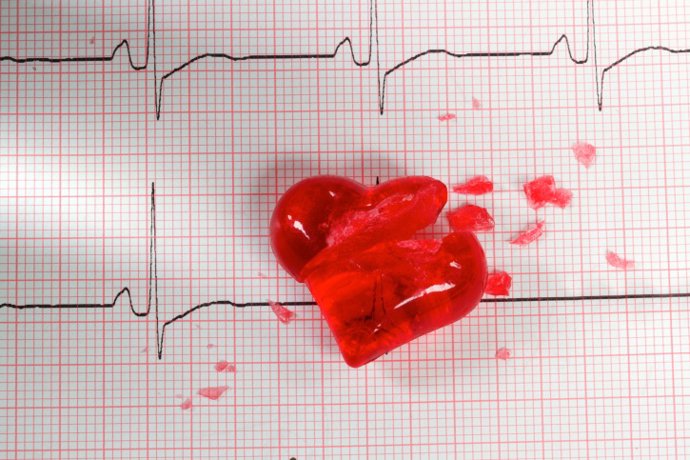 ECG cardiogram with broken heart...