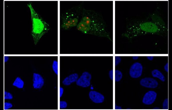 La replicación del virus de la hepatitis D (rojo) induce autofagia (verde) en la célula huésped (microscopía de fluorescencia).