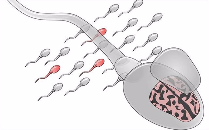 Ilustración del mosaico de los espermatozoides. Los espermatozoides mutados se representan en rojo.