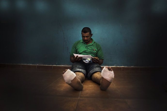 México.- Un brote de varicela obliga a cerrar temporalmente un albergue de migra