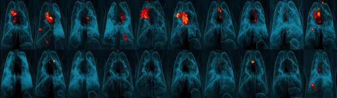 Pulmones de mono que muestran inflamación (roja y amarilla) por infección de tuberculosis