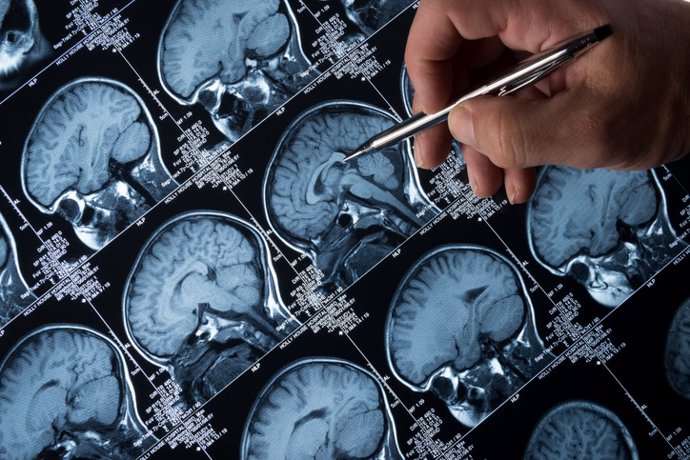 MRI Brain Scan of head and skull with hand pointing