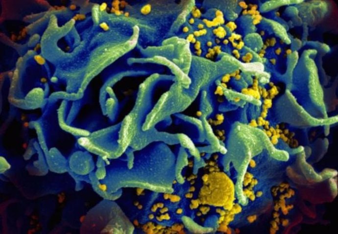 Imagen microscópica de una célula T infectada con VIH