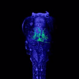 La imagen muestra un embrión de pez cebra con células cancerosas (verde) en su sistema nervioso. Los investigadores utilizaron este tipo de modelo animal para evaluar nuevos tratamientos.