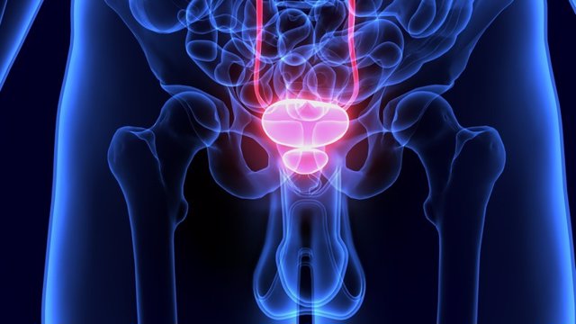 Solo 3 de cada 10 hombres con incontinencia urinaria postquirúrgica son tratados por urólogos