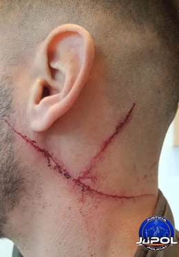 Heridas recibidas por un GEO fuera de servicio durante una discusión de tráfico en Alcorcón