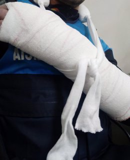 Imagen de uno de los agentes de Policía Municipal de Alcorcón herido durante la detención de un individuo.