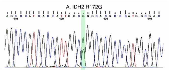 Imagen de la mutación hallada en el gen IDH2.
