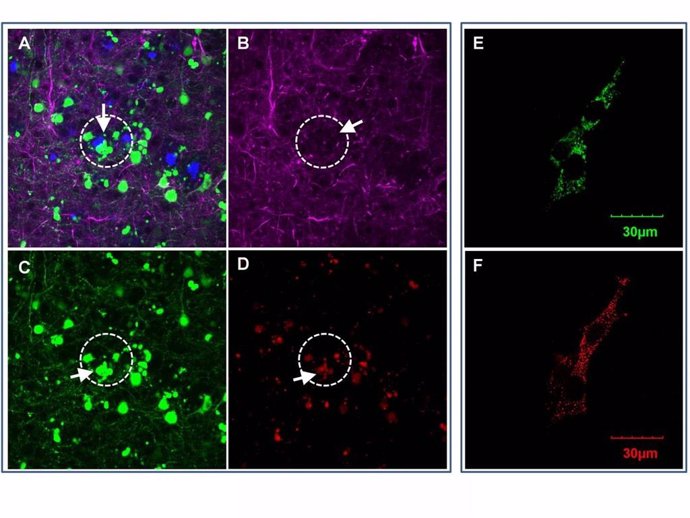 En el cerebro de ratones con Alzheimer, aparecen áreas cercanas a las placas amiloides (A) con menos redes neuronales (B), neuronas moribundas (C) y mayor OCIAD1 (D). En células neuronales cultivadas, las proteínas OCIAD1 (E) aparecen en las mitocondrias