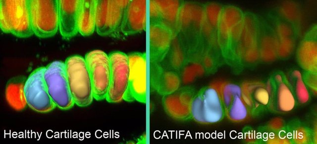 Las células de cartílago en el modelo de pez cebra de la enfermedad CATIFA (derecha) tienen volúmenes reducidos y formas irregulares en comparación con las células de cartílago sanas (izquierda) debido a un defecto en la secreción de colágeno.