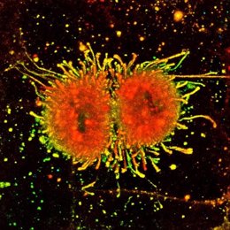 La imagen muestra una célula de melanoma en división con sus espigas en forma de erizo. La célula también secreta vesículas.