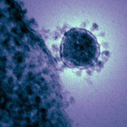 Imagen de archivo de un coronavirus.