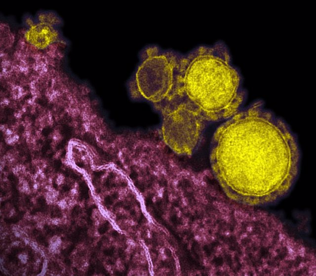 Nuevo coronavirus- MERS-