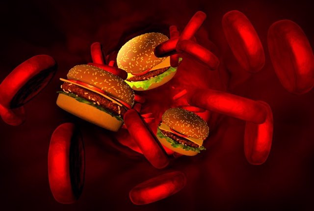 Colesterol, arterias con hamburguesas.