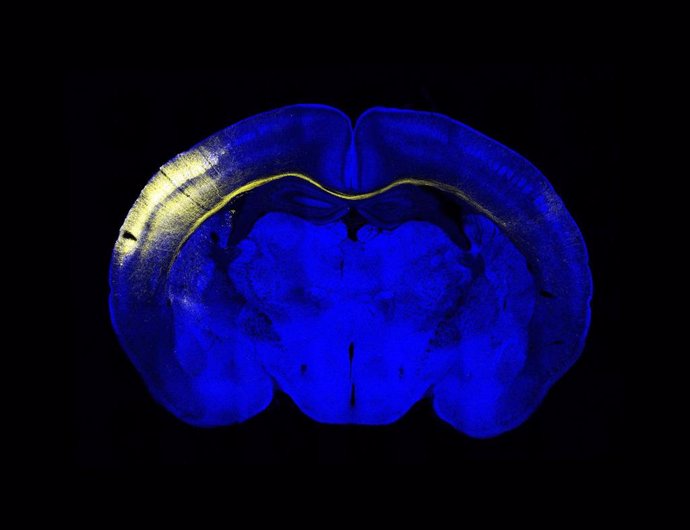 Sección horizontal del cerebro del ratón. Un grupo de neuronas de la corteza iluminadas en amarillo extienden sus axones a través del cuerpo calloso para conectar con el hemisferio contralateral.