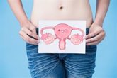 Foto: Un fármaco para la endometriosis puede ser eficaz en la reducción del sangrado menstrual en mujeres con fibromas