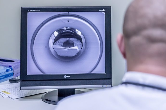 La resonancia magnética ha mejorado el diagnóstico precoz de las espondiloartiti