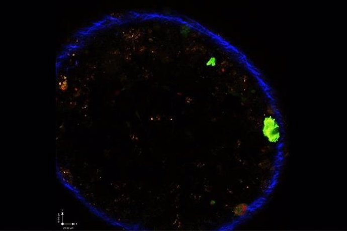 El parásito (rojo) no necesita infectar una célula inmune para alterar su comportamiento El simple hecho de que el parásito le inyecte un paquete de proteínas (indicado por las células que se ponen de color verde) es suficiente para cambiar la actividad.