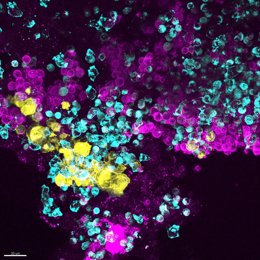 Esta imagen inmunofluorescente muestra los múltiples tipos de células que se desarrollan dentro del chip de la médula ósea humana (magenta: células eritroides, amarillo: megacariocitos, azul: otras células hematopoyéticas)