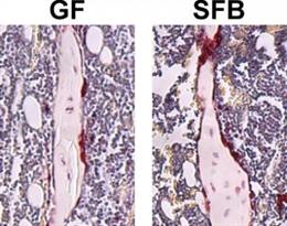 Fosfatasa ácida resistente a los tartratos (TRAP) teñida en las tibias de ratones libres de gérmenes (GF) y de bacterias filamentosas segmentadas (SFB) monoasociadas