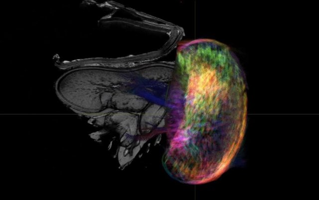 Detalle del cerebro del calamar en el nuevo mapa en resonancia magnética