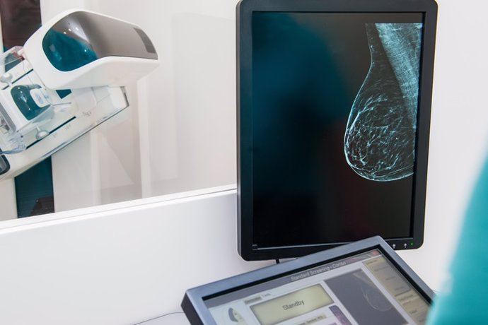 Imagen de una mamografía para detectar cáncer de mama