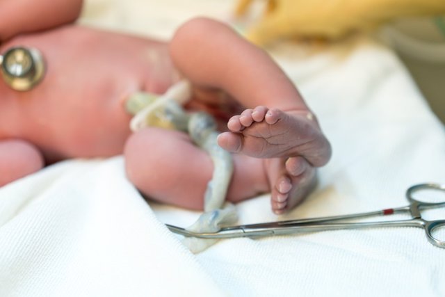 New born baby, feet and umbilical cord