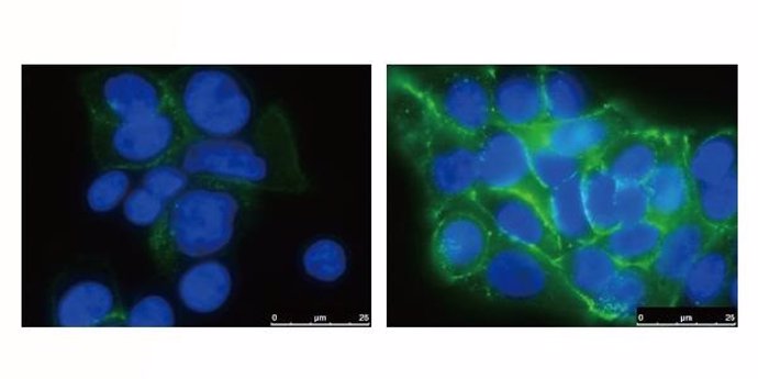 El silenciamiento de BACH1 (imagen derecha) aumenta la producción de cadherina E (verde), manteniendo las células del páncreas unidas y haciendo más difícil que hagan metástasis.